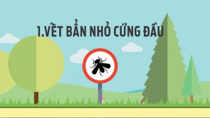 Hình ảnh 7 “mối nguy” dẫn đến trầy, xước sơn xe số 1